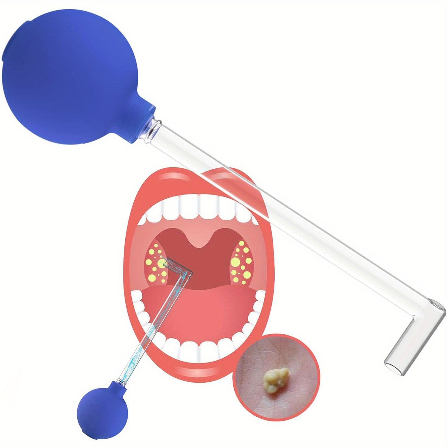 Tonsil Stone Removal Vacuum Set with PVC Suction Ball, Oral Hygiene Tool for Mouth Suction.