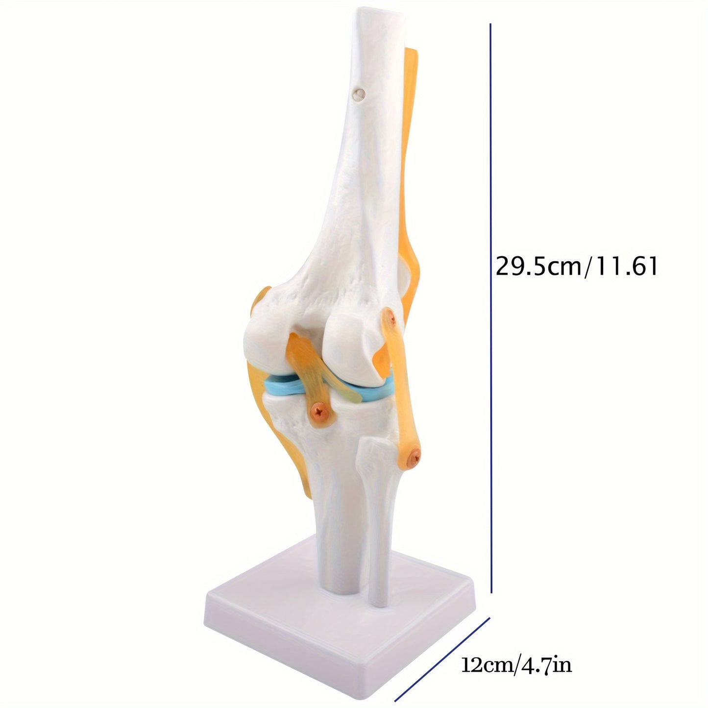 Life size, lightweight knee joint model with ligaments for anatomy education and patient understanding.