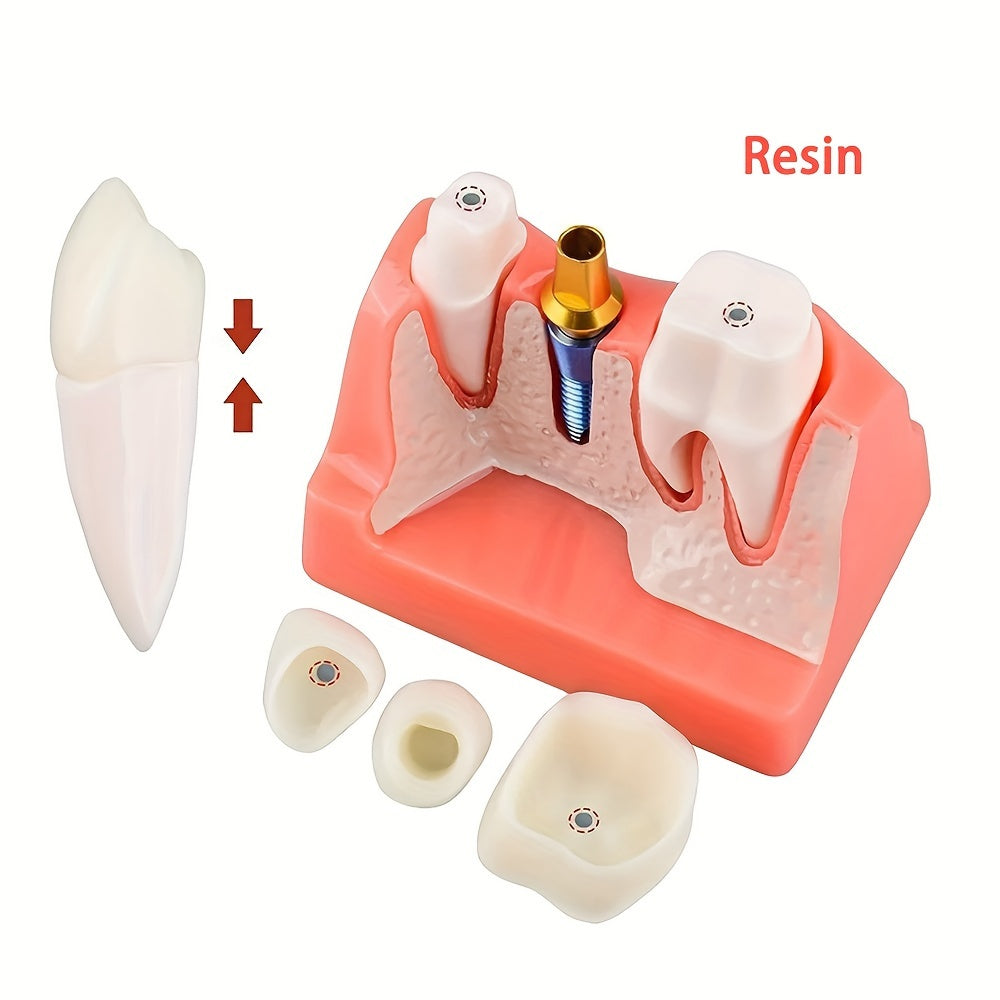 Съемная модель зубного имплантата с 4 коронковыми мостами, PVC материал для образования и изучения