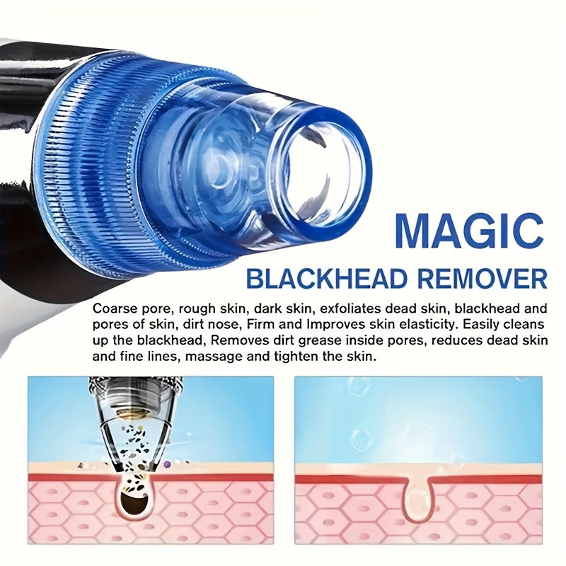 This device comes with four suction heads to safely remove blackheads.