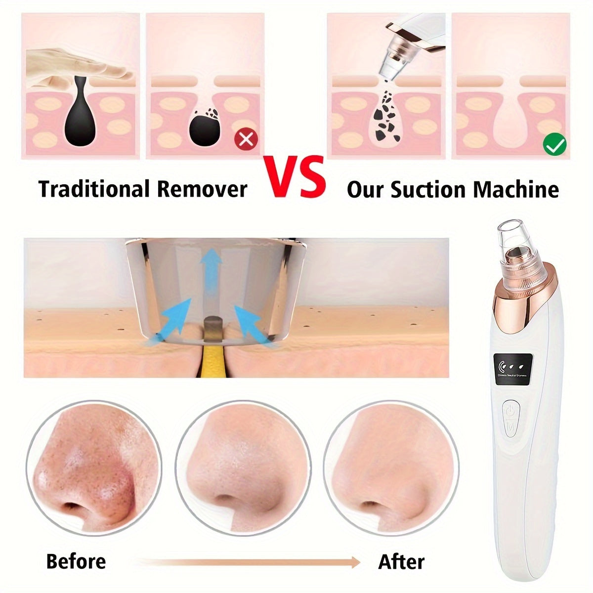 USB Rechargeable Blackhead Remover with 350mAh Lithium Battery for Acne & Mites.