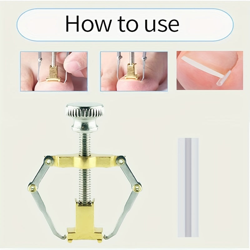 Newly upgraded ingrown nail correction tool for foot care.