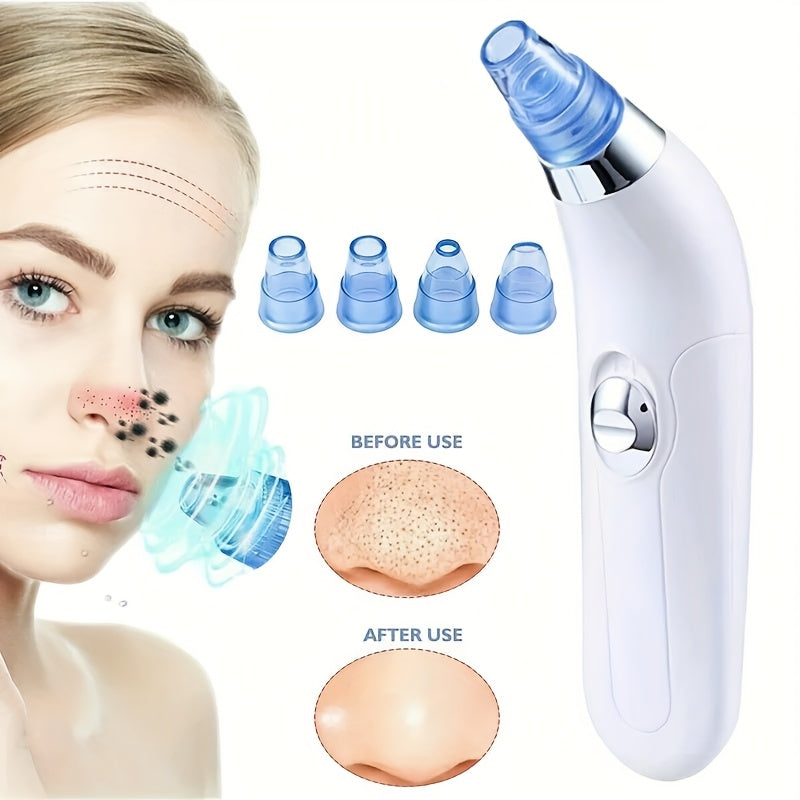 This device comes with four suction heads to safely remove blackheads.