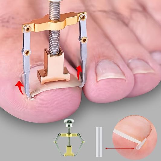 Newly upgraded ingrown nail correction tool for foot care.